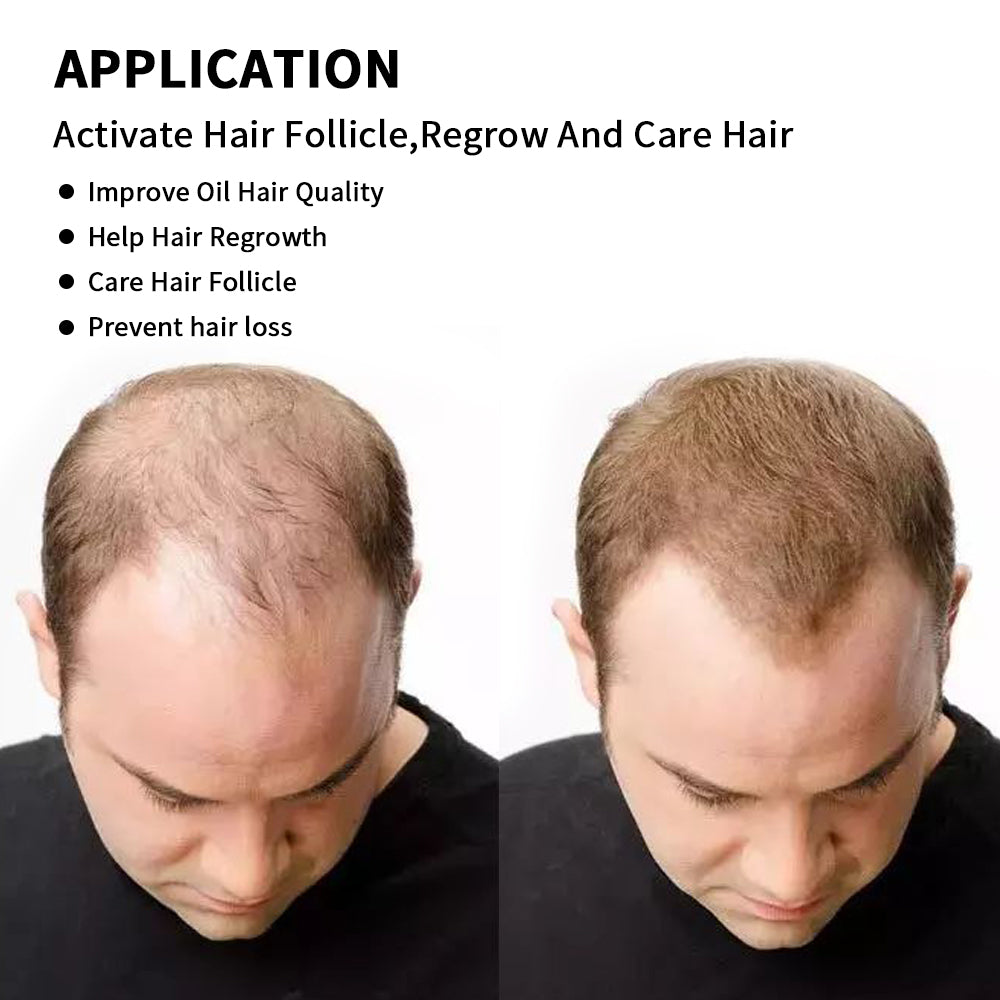 Hair Growth Therapy Cap – Red Light Treatment – SmartNetwork