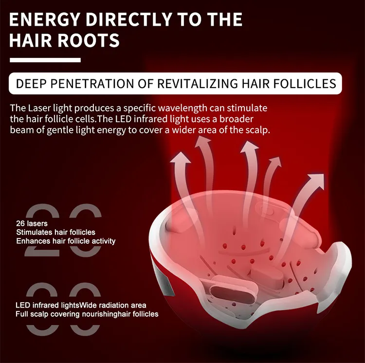 Hair Growth Helmet – Laser Hair Treatment – SmartNetwork