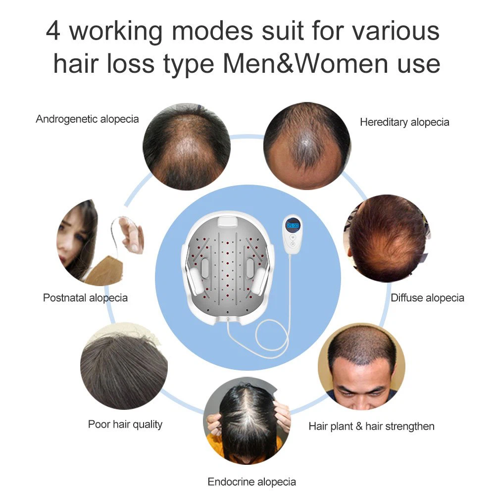 Hair Growth Helmet – Laser Hair Treatment – SmartNetwork